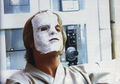 Luke bandaged face.jpg